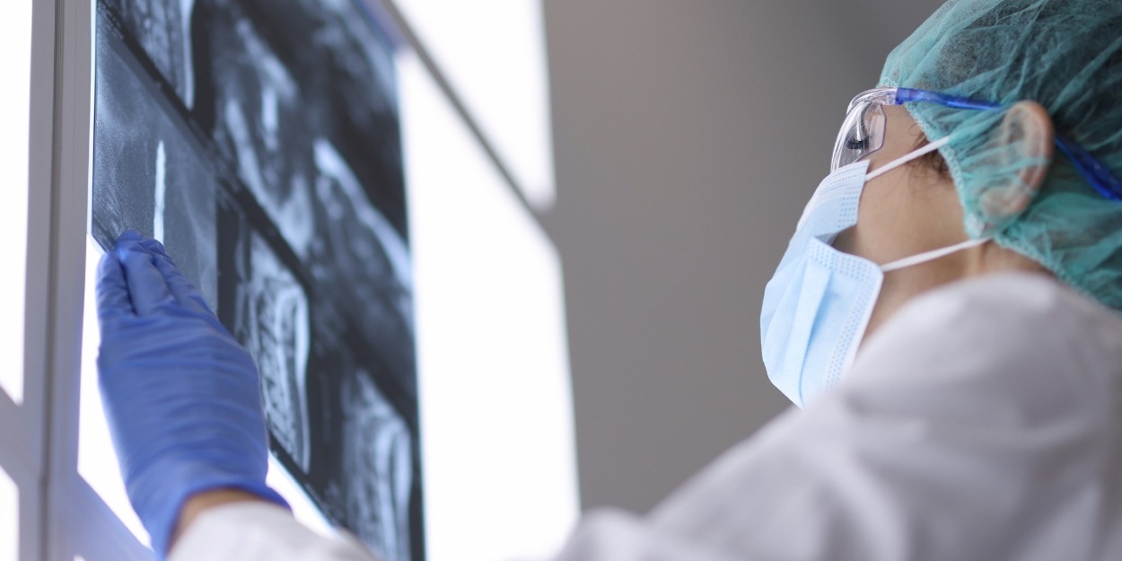 Doctor reviewing scans of a young man who suffered a spinal cord injury in a serious car accident.