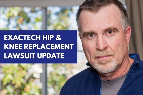 How to file an Protect your rights by filing an Exactech Hip Replacement Lawsuit..