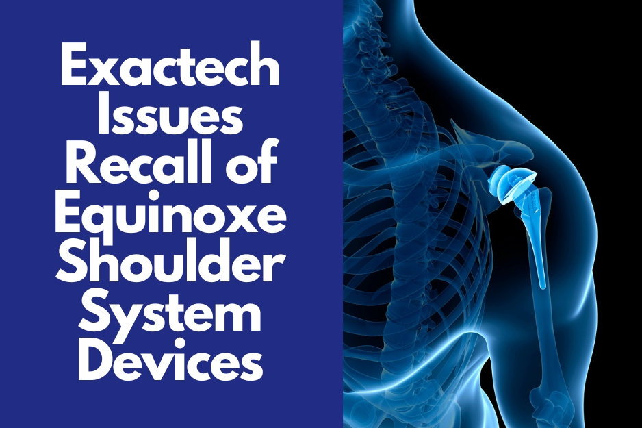 Exactech Issues Equinoxe Shoulder Replacement Recall lawsuit