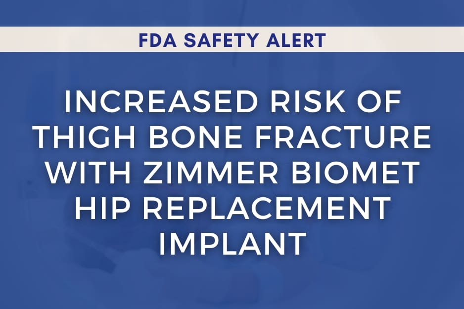 Zimmer Hip Implant Recall Due to Increased Risk of Bone Fracture