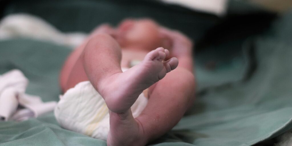 What is a low Apgar score