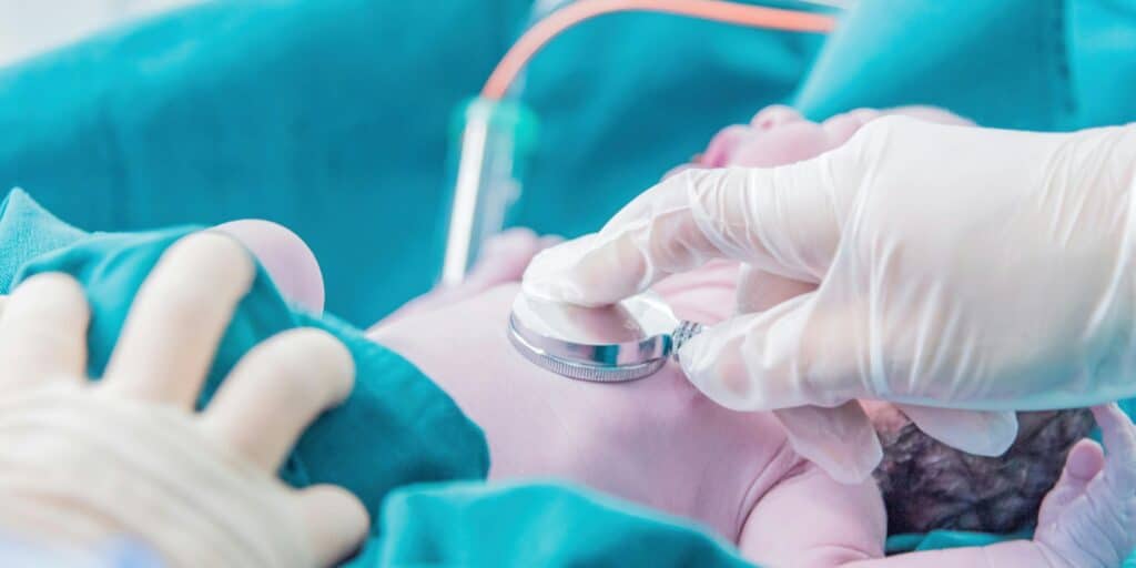 Neonatal Resuscitation due to medical malpractice