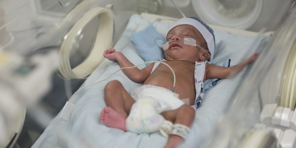 What are the Common Causes of a Nuchal Cord